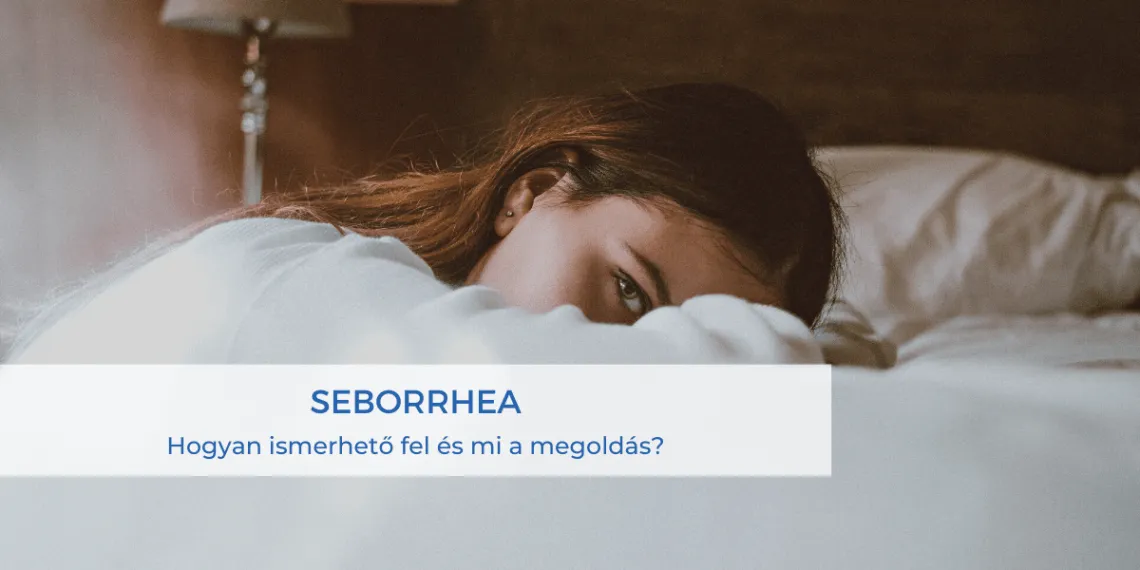 Seborrhea - Hogyan ismerhető fel és mi a megoldás?
