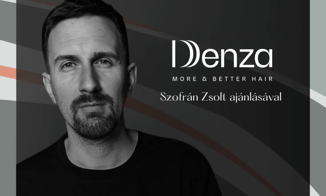 Fodrászok ajánlásával: Denza lézeres hajhullás elleni kezelés