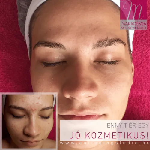 Mire képes a jó kozmetikus?